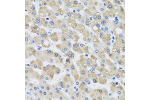 Immunohistochemistry of paraffin-embedded human liver injury using SNAP29 antibody. (SNAP29 antibody  (AA 1-258))