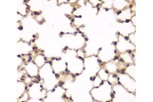 Immunohistochemistry of paraffin-embedded Mouse lung using PIP4K2A Polyclonal Antibody at dilution of 1:100 (40x lens). (PIP4K2A antibody)