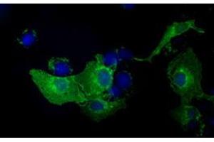 Anti-KIAA1609 mouse monoclonal antibody (ABIN2453202) immunofluorescent staining of COS7 cells transiently transfected by pCMV6-ENTRY KIAA1609 (RC209287). (KIAA1609 antibody)
