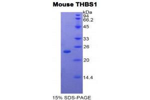 SDS-PAGE (SDS) image for Thrombospondin 1 (THBS1) (AA 957-1129) protein (His tag) (ABIN1878165) (Thrombospondin 1 Protein (THBS1) (AA 957-1129) (His tag))