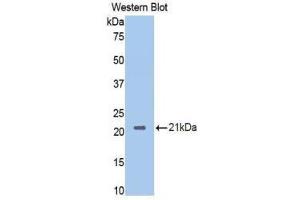 Western Blotting (WB) image for anti-Neuropilin 1 (NRP1) (AA 275-424) antibody (ABIN1860058) (Neuropilin 1 antibody  (AA 275-424))