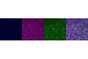 Immunohistochemistry (IHC) image for anti-ATP Synthase, H+ Transporting, Mitochondrial F1 Complex, alpha Subunit 1, Cardiac Muscle (ATP5A1) antibody (ABIN7456339)