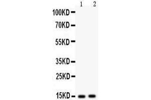Western Blotting (WB) image for anti-Fatty Acid Binding Protein 5 (Psoriasis-Associated) (FABP5) (AA 2-16), (N-Term) antibody (ABIN3043194)
