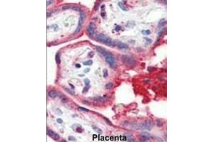 Immunohistochemistry (Paraffin-embedded Sections) (IHC (p)) image for anti-Apolipoprotein A-I (APOA1) (AA 10-37), (N-Term) antibody (ABIN391612)