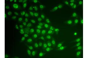 Immunofluorescence analysis of HeLa cells using CRY2 antibody (ABIN6291959). (CRY2 antibody)