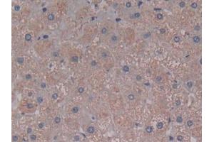 DAB staining on IHC-P; Samples: Human Liver Tissue (C5A antibody  (AA 678-751))