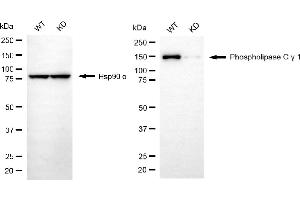 Western blotting analysis using phospholipase C gamma 1 antibody (ABIN7799823). (Recombinant Phospholipase C gamma 1 antibody)
