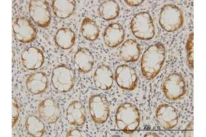 Image no. 1 for anti-Ceramide Synthase 6 (CERS6) (AA 62-132) antibody (ABIN466277) (CERS6 antibody  (AA 62-132))
