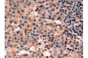 Immunohistochemistry (IHC) image for anti-Protein tyrosine Phosphatase, Receptor Type, C (PTPRC) (AA 193-575) antibody (ABIN7436852)