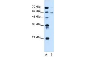 Image no. 2 for anti-Asparagine-Linked Glycosylation 11, alpha-1,2-Mannosyltransferase Homolog (Yeast) (ALG11) (AA 392-441) antibody (ABIN6736673)