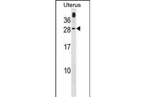GUCA1C Antibody (C-term) (ABIN1881400 and ABIN2839072) western blot analysis in human Uterus tissue lysates (35 μg/lane).