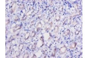 Immunohistochemistry of paraffin-embedded human kidney tissue using ABIN7151548 at dilution of 1:50 (EEF2 antibody  (AA 2-858))