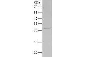 Western Blotting (WB) image for PSME3 (PSME3) (AA 1-267) protein (His tag) (ABIN7286648) (PSME3 Protein (PSME3) (AA 1-267) (His tag))