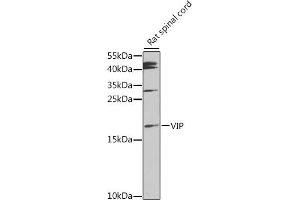 Western blot analysis of extracts of rat spinal cord, using VIP antibody (ABIN6130781, ABIN6150111, ABIN6150112 and ABIN6216193) at 1:1000 dilution. (Vip antibody  (AA 31-170))