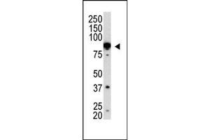 Image no. 1 for anti-Protein Inhibitor of Activated STAT, 2 (PIAS2) (C-Term) antibody (ABIN356767) (PIAS2 antibody  (C-Term))