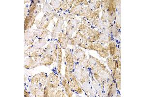 Immunohistochemistry of paraffin-embedded rat heart using MBNL1 antibody at dilution of 1:100 (x40 lens).
