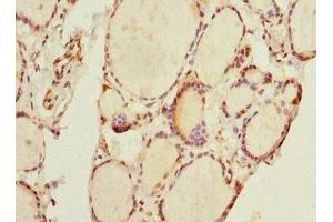 Immunohistochemistry of paraffin-embedded human thyroid tissue using ABIN7172156 at dilution of 1:100 (THRSP antibody  (AA 1-146))