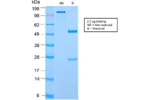 SDS-PAGE Analysis of Purified Secretory Component Rabbit Recombinant Monoclonal (ECM1/2889R). (Recombinant ECM1 antibody)