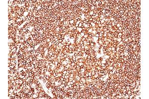 Formalin-fixed, paraffin-embedded human Tonsil stained with CD45 Mouse Monoclonal Antibody (2B11+PD7/26). (CD45 antibody  (FITC))