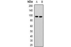 Western blot analysis of KANSL3 expression in Jurkat (A), U251 (B) whole cell lysates. (KANSL3 antibody)