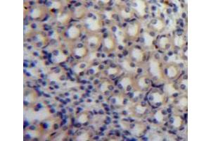 #VALUE! (S100A3 antibody  (AA 1-101))