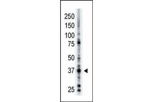 The anti-ART1 Pab (ABIN389008 and ABIN2839233) is used in Western blot to detect ART1 in mouse brain tissue lysate. (ART1 antibody  (N-Term))