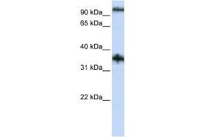 C9ORF4 antibody used at 1 ug/ml to detect target protein. (Ferric-Chelate Reductase 1 Like (FRRS1L) (N-Term) antibody)