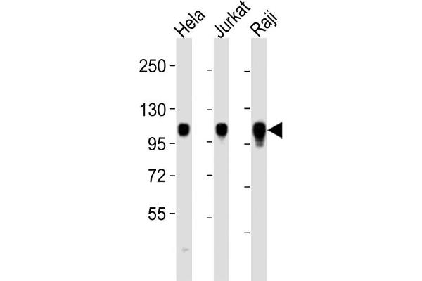 ITGA7 antibody  (C-Term)