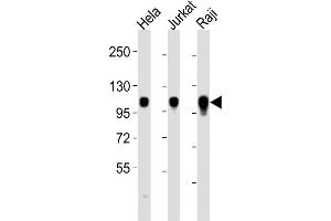 ITGA7 anticorps  (C-Term)