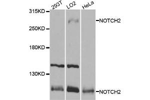 Western blot analysis of extracts of various cell lines, using NOTCH2 antibody. (NOTCH2 antibody)