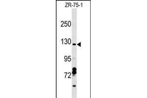 CCD Antibody (C-term) (ABIN1537645 and ABIN2849114) western blot analysis in ZR-75-1 cell line lysates (35 μg/lane). (Syndetin/VPS50 antibody  (C-Term))