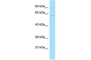 WB Suggested Anti-ZC3H12D Antibody Titration: 1.