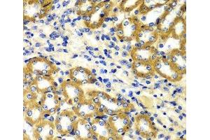 Immunohistochemistry of paraffin-embedded mouse kidney using TOMM20 antibody. (TOMM20 antibody)
