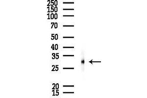 anti-Proteasome Subunit alpha Type 1 (PSMA1) (C-Term) antibody
