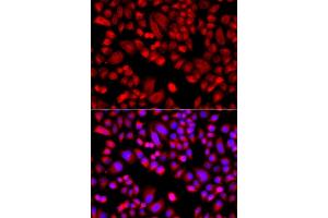 Immunofluorescence analysis of  cells using  antibody (ABIN6129197, ABIN6137129, ABIN6137130 and ABIN6223718). (ARPC3 antibody  (AA 1-178))