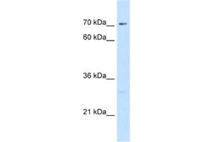 Western Blotting (WB) image for anti-CTP Synthase (CTPS) antibody (ABIN2462930) (CTP Synthase antibody)