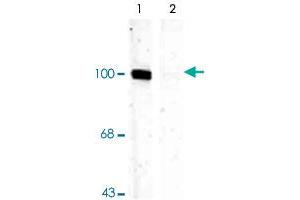 Western blot of rat hippocampal lysate showing specific immunolabeling of the ~100k Gria1 protein phosphorylated at Ser831 (Control). (Glutamate Receptor 1 antibody  (pSer831))