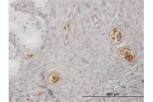 Immunoperoxidase of monoclonal antibody to HBZ on formalin-fixed paraffin-embedded human prostate.
