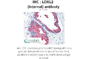 Image no. 2 for anti-Lysyl Oxidase-Like 2 (LOXL2) (Internal Region) antibody (ABIN1736515) (LOXL2 antibody  (Internal Region))