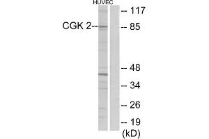 Western blot analysis of extracts from HUVEC cells, using CGK 2 antibody. (PRKG2 antibody  (Internal Region))