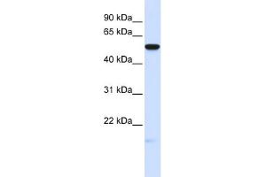 WB Suggested Anti-MFRP Antibody Titration:  0. (MFRP antibody  (Middle Region))