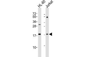 All lanes : Anti-KISS1 Antibody (N-Term) at 1:2000 dilution Lane 1: HL-60 whole cell lysates Lane 2: Jurkat whole cell lysates Lysates/proteins at 20 μg per lane. (KISS1 antibody  (AA 20-52))