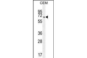 COX10 Antibody (C-term) (ABIN654671 and ABIN2844366) western blot analysis in CEM cell line lysates (35 μg/lane). (COX10 antibody  (C-Term))