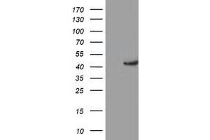 Western Blotting (WB) image for anti-Potassium Voltage-Gated Channel, Shaker-Related Subfamily, beta Member 1 (KCNAB1) antibody (ABIN1498998) (KCNAB1 antibody)