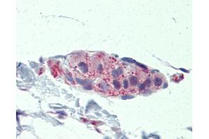 Immunohistochemistry (IHC) image for anti-Tankyrase, TRF1-Interacting Ankyrin-Related ADP-Ribose Polymerase (TNKS) (Middle Region) antibody (ABIN404896) (TNKS antibody  (Middle Region))