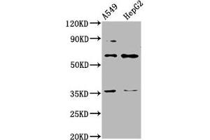 Western Blot Positive WB detected in: A549 whole cell lysate, HepG2 whole cell lysate All lanes: TBX4 antibody at 4. (TBX4 antibody  (AA 355-511))