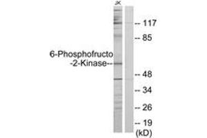 Western blot analysis of extracts from Jurkat cells, using PFKFB2 Antibody. (PFKFB2 antibody  (AA 1-50))