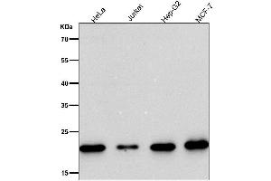 All lanes use the Antibody at 1:1W dilution for 1 hour at room temperature.