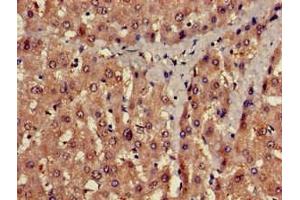 Immunohistochemistry of paraffin-embedded human liver tissue using ABIN7175541 at dilution of 1:100 (PROC antibody  (AA 288-409))