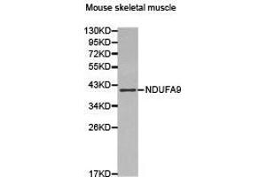 Western Blotting (WB) image for anti-NADH Dehydrogenase (Ubiquinone) 1 alpha Subcomplex, 9, 39kDa (NDUFA9) antibody (ABIN2650936) (NDUFA9 antibody)